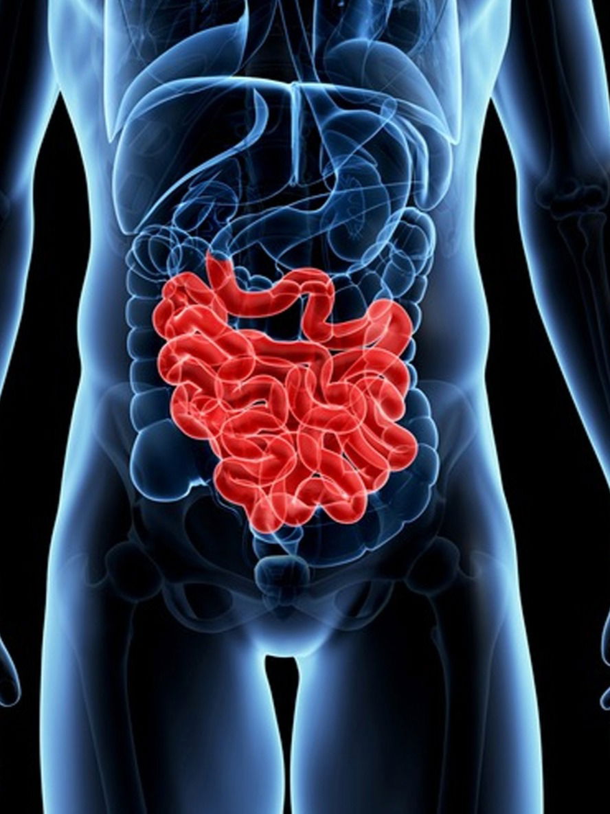 What Is Neuroendocrine Colon Cancer? The Rare Disease That Took Vibhu Raghave’s Life | What Is Neuroendocrine Colon Cancer? The Rare Disease That Took Vibhu Raghave’s Life What Is Neuroendocrine Colon Cancer? The Rare Disease That Took Vibhu Raghave’s Life | What Is Neuroendocrine Colon Cancer? The Rare Disease That Took Vibhu Raghave’s Life